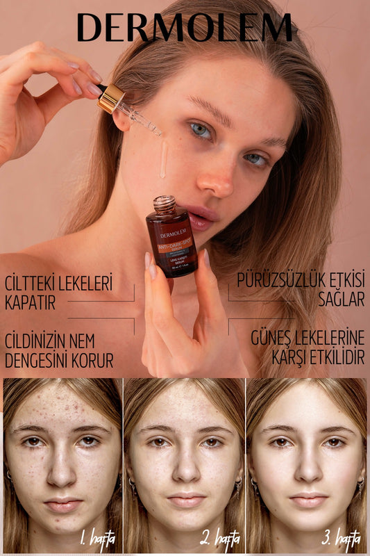 Dermolem Leke Karşıtı Serum | Cilt Tonu Eşitleyici & Aydınlatıcı Cilt Serumu 30 ml